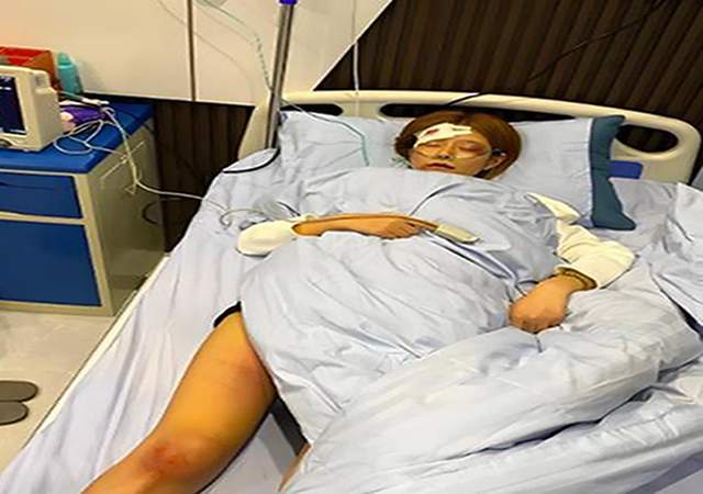 女子独自深夜回家被人扯着头发暴打球盟会网站回顾：电梯里气愤一幕